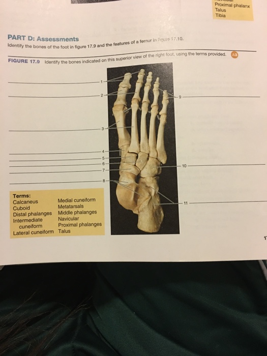 Solved Identify the bones of the foot in figure 17.9 and the | Chegg.com