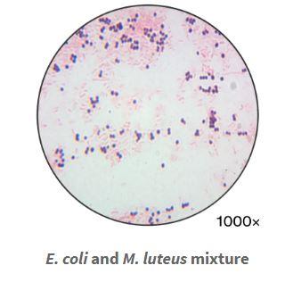 E. coll and M. luteus mixture