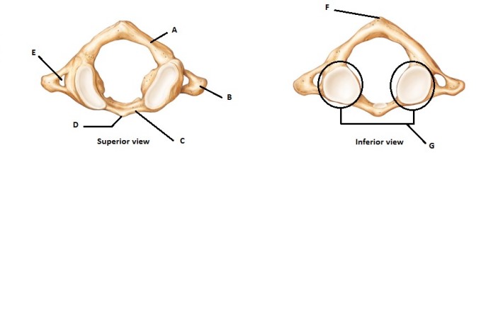 Solved I need help with labeling this diagrams: | Chegg.com