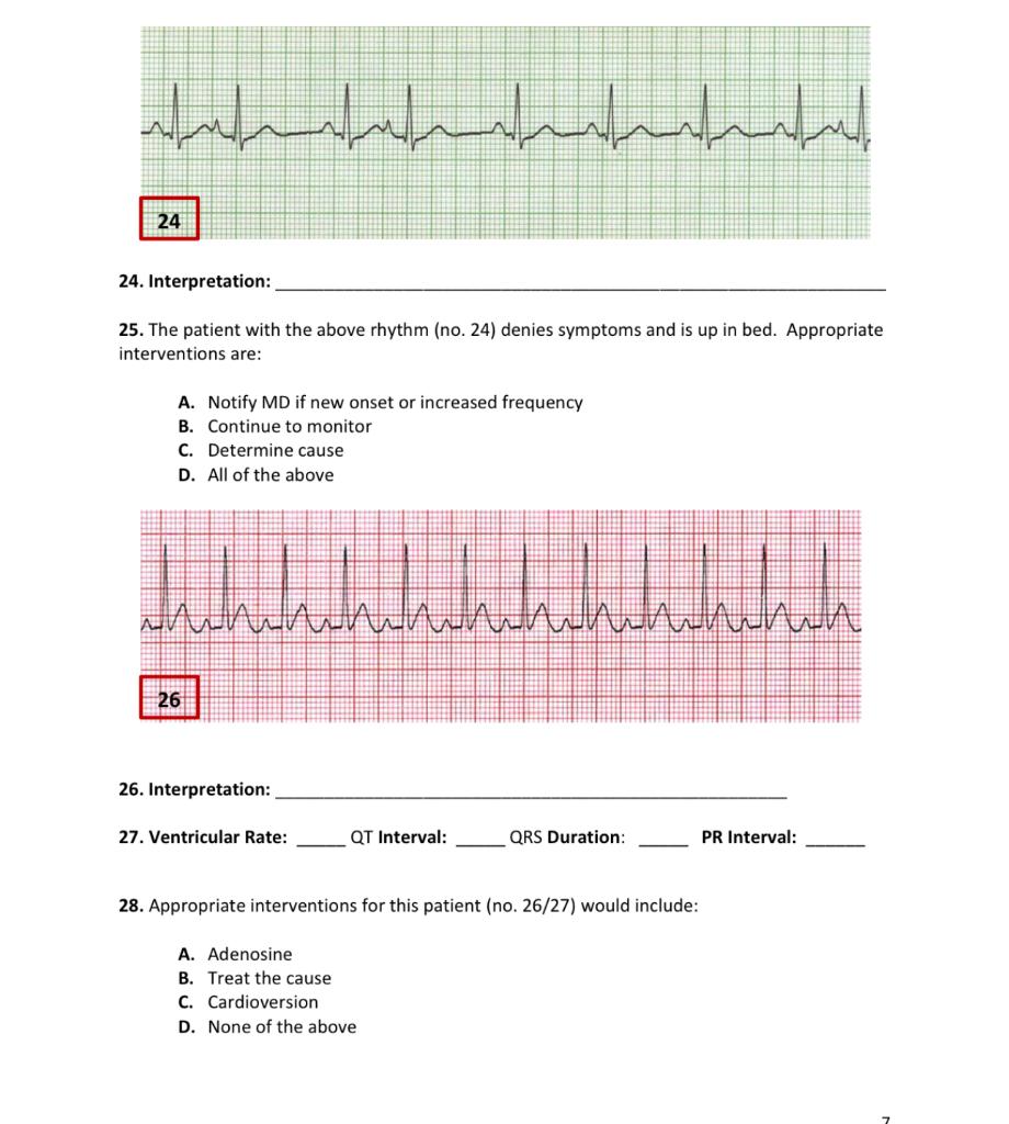 Solved 25. The patient with the above rhythm (no. 24) denies | Chegg.com