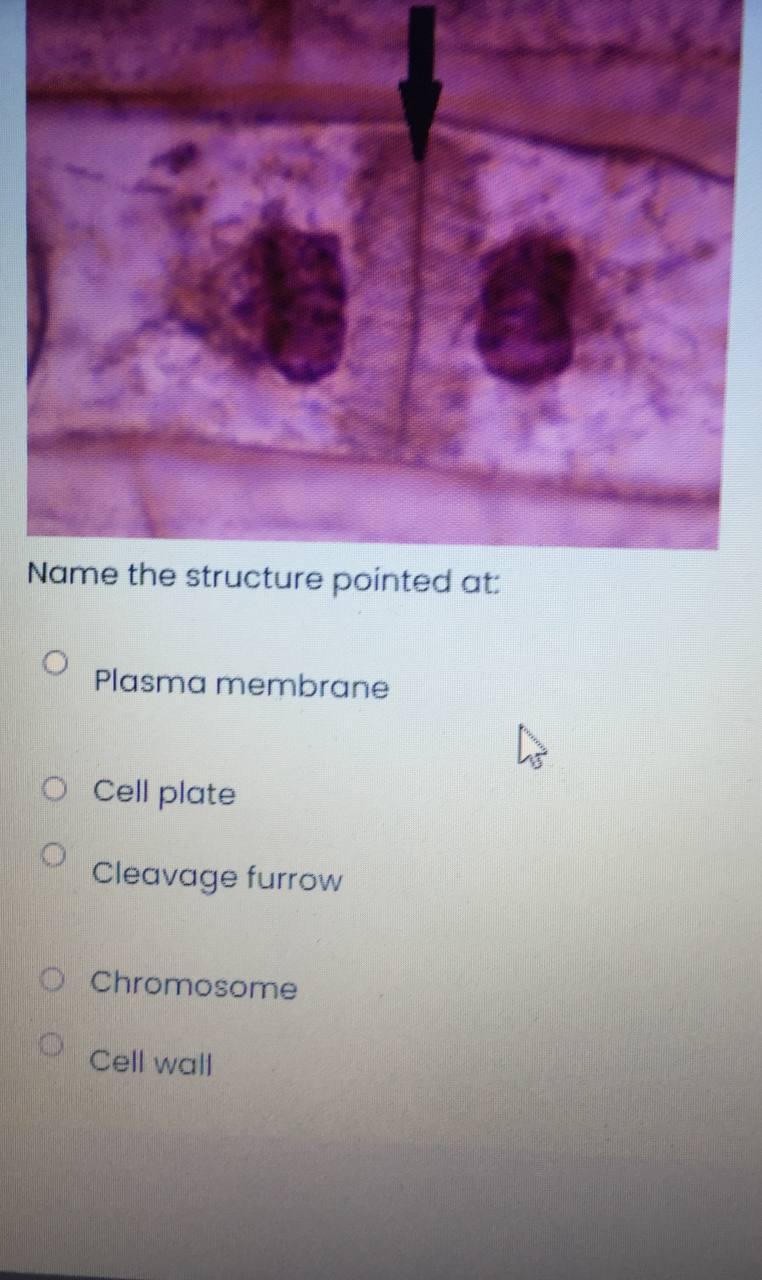 Solved Name the structure pointed at: Plasma membrane O Cell | Chegg.com