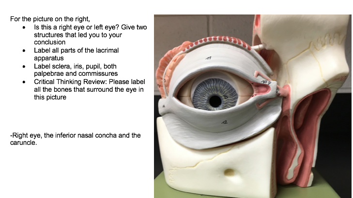 eye model labeled lacrimal gland