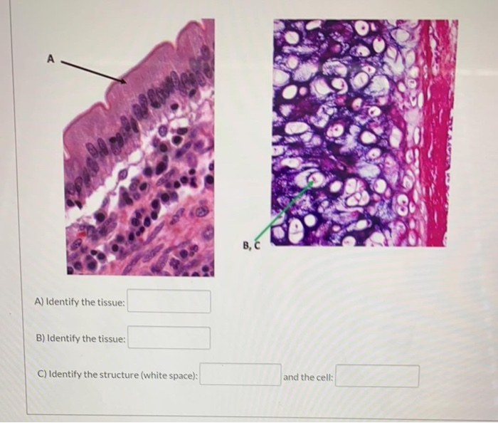 Solved A B, C A) Identify The Tissue: B) Identify The | Chegg.com