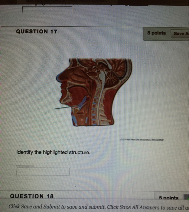 Solved QUESTION 17 5 points Save A Identify the highlighted | Chegg.com
