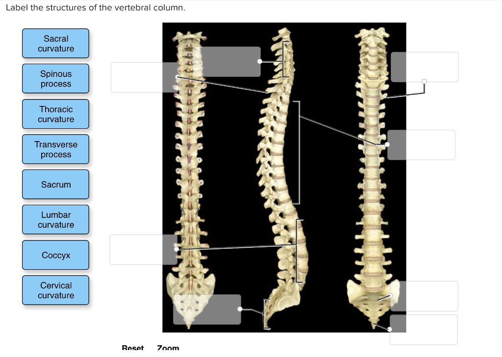 solved-label-the-structures-of-the-vertebral-column-sacral-chegg