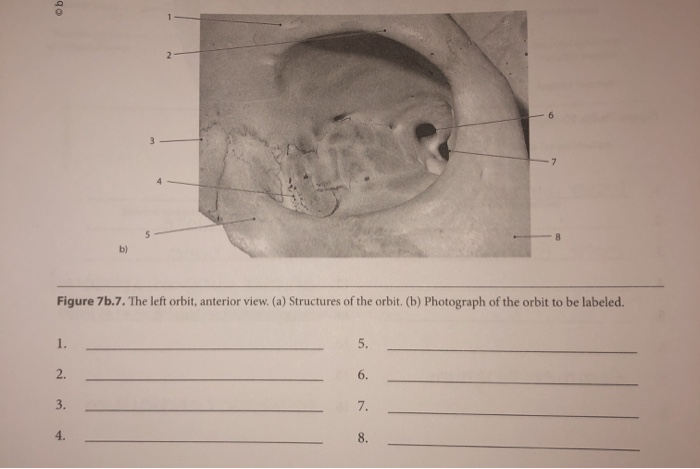 Solved 2 6 3 7 bl Figure 7b.7. The left orbit, anterior | Chegg.com