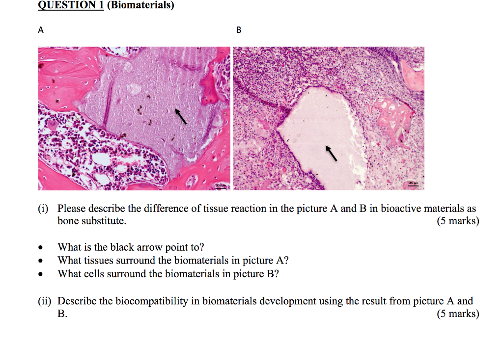 QUESTION 1 (Biomaterials) A B (i) Please describe the
