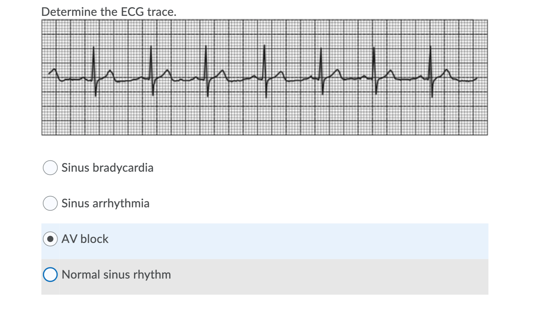 Determine Which Ecg Trace Ecg2 Www Atrial Chegg Com