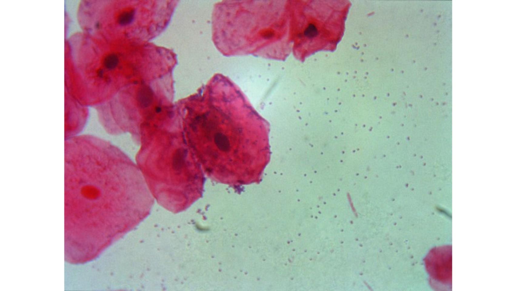 solved-label-and-identify-one-prokaryotic-cell-and-one-chegg