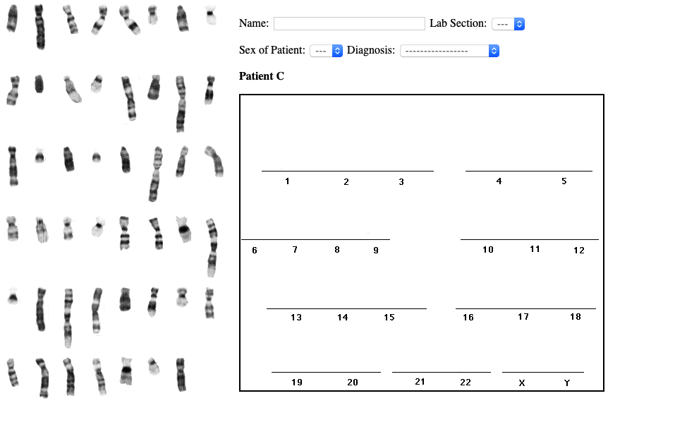 Solved Human Karyotype Lab Exercise WARNING Read all of the