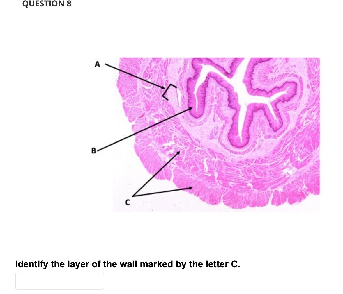 Solved 1 Which structure regulates bile and secretion flow Biology Diagrams
