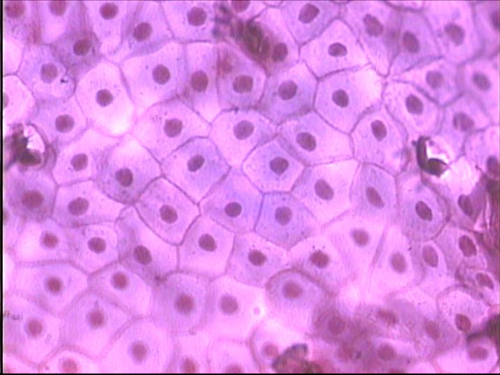 stratified squamous epithelium keratinized 400x