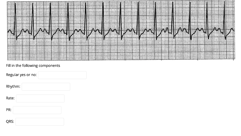 mmmmmmmmmmmm Fill in the following components Regular yes or no: Rhythm: Rate: PR: QRS: