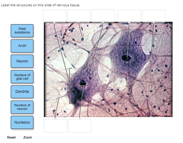 Solved Label the structures on this slide of nervous tissue. | Chegg.com