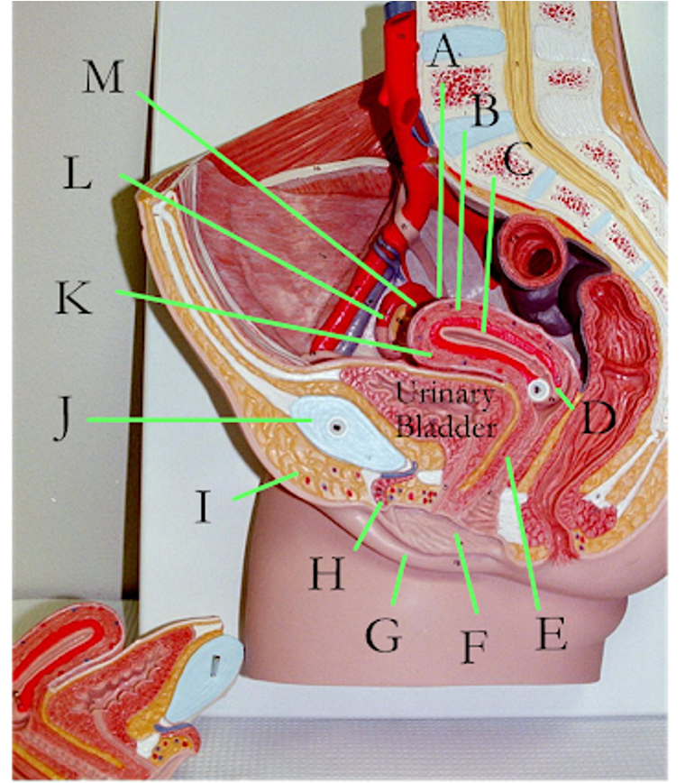 Solved Label the parts of the female urinary/reproductive