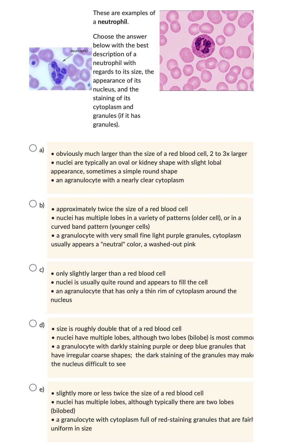 Solved These are examples of a lymphocyte. Choose the answer