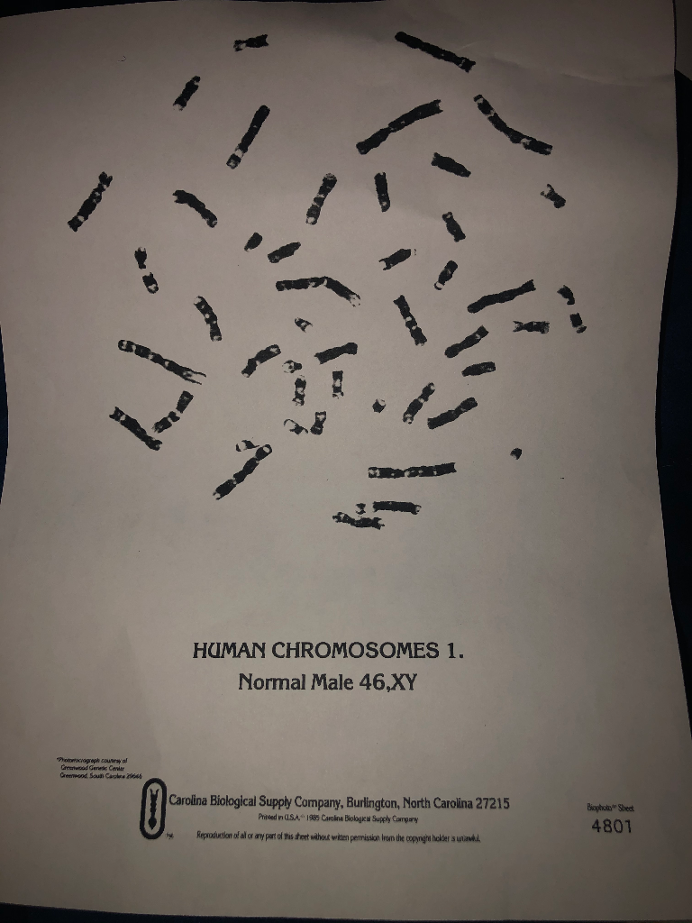 Solved HUMAN KARYOTYPE FORM 20 B А 200 20 20 ¿ 20 20 120 20 20 E For Biology Karyotype Worksheet Answers Key