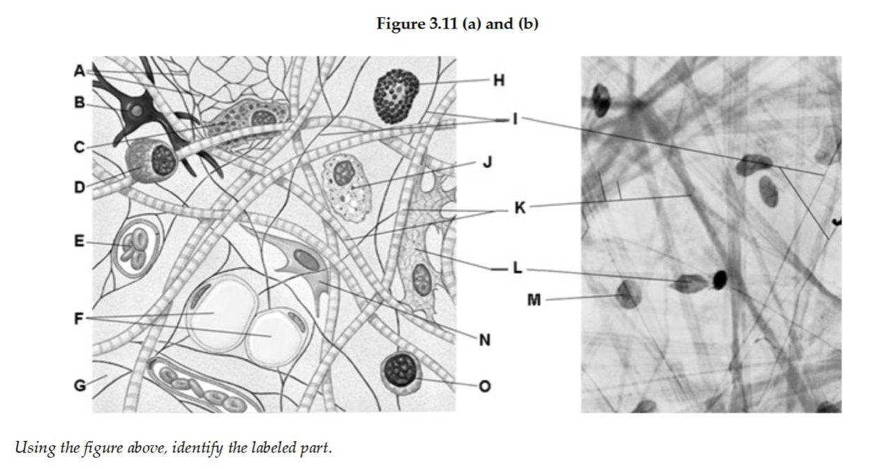 Figure 3.11