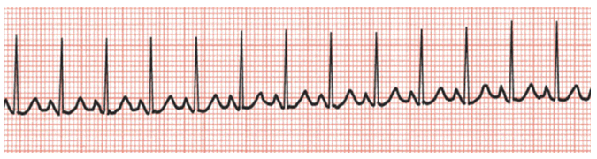 Solved 1. A patient arrives for a routine physical and you | Chegg.com