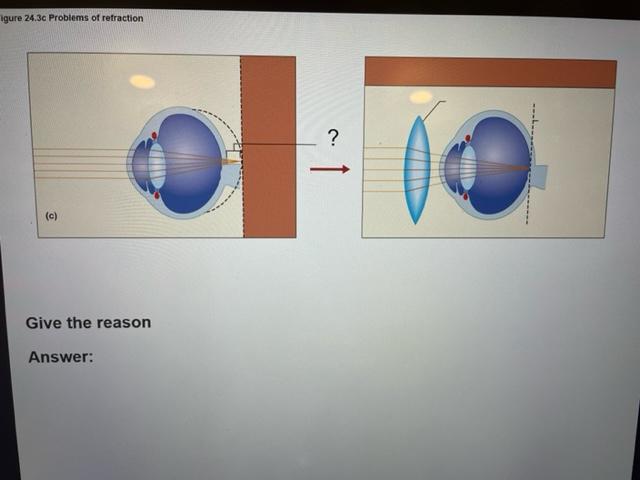 Solved Identify the cause for this problem in light | Chegg.com