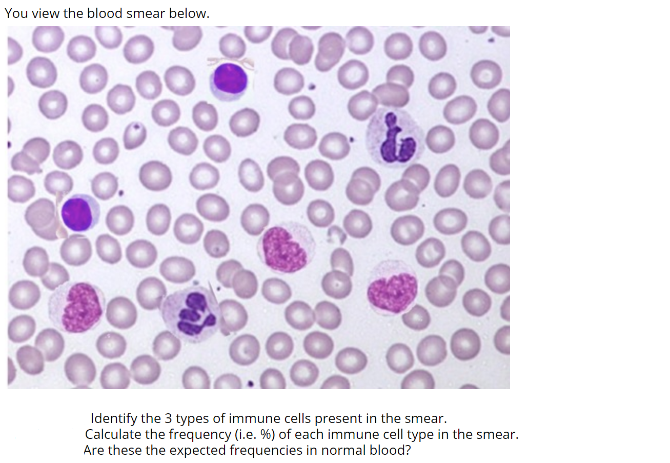 Solved You view the blood smear below. od Identify the 3 | Chegg.com