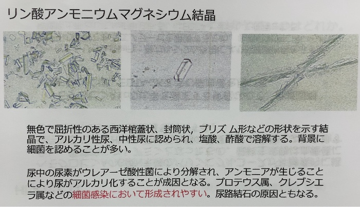 国試 検査総論 尿沈渣 Flashcards Chegg Com