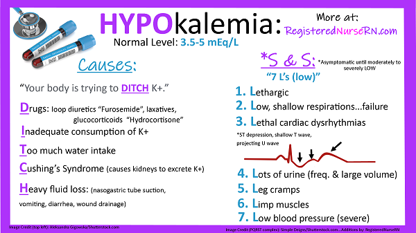 hypomagnesemia mnemonic