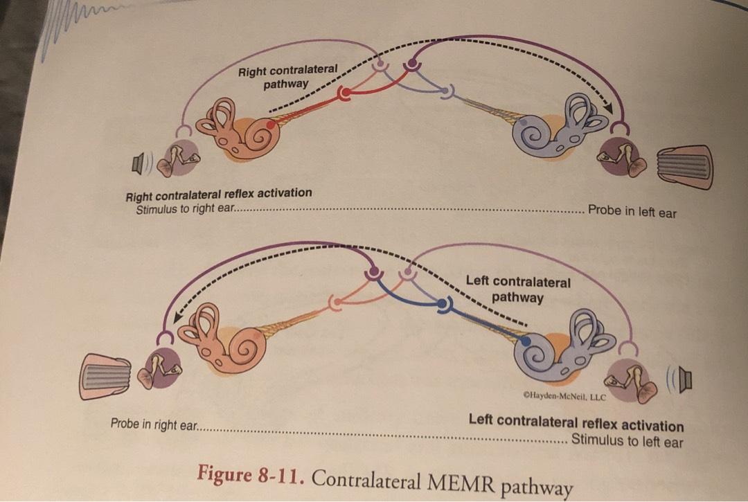 auditory reflex pathway