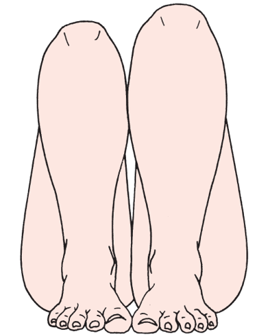 Allis Sign Leg