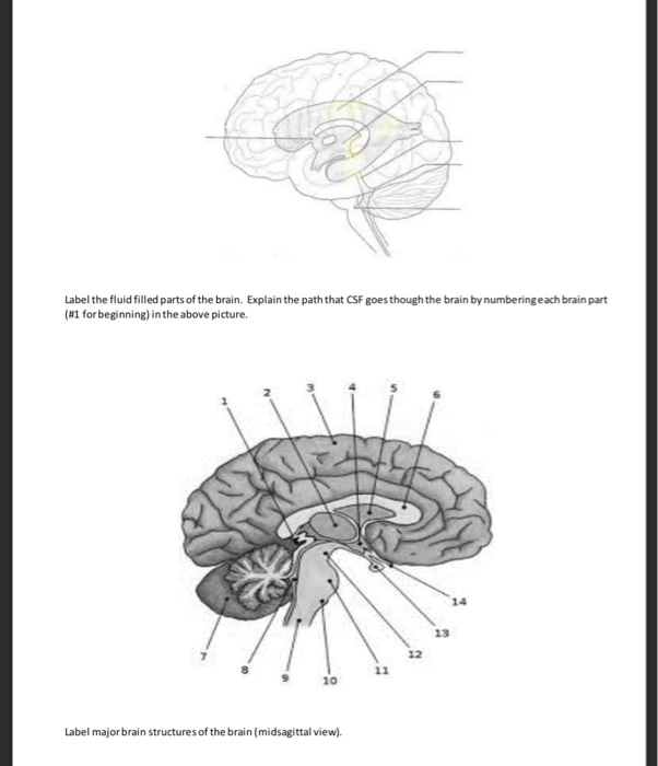 Solved Label The Fluid Filled Parts Of The Brain. Explain 