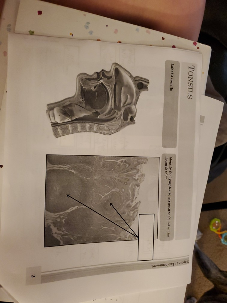 Solved TONSILS Label 4 tonsils Identify the lymphatic