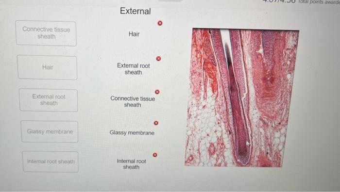 Glassy membrane Internal root sheath | Chegg.com