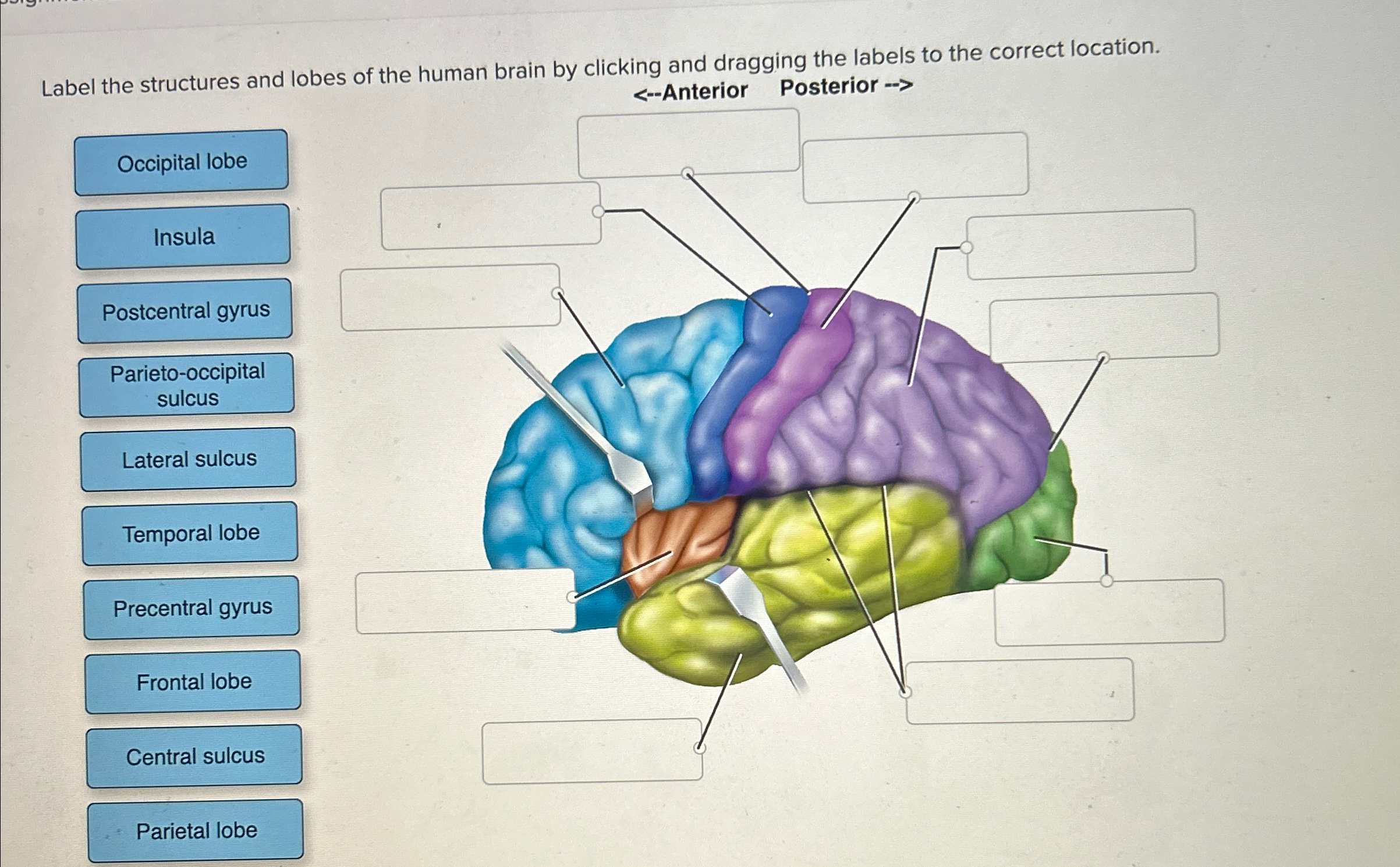 Solved Label the structures and lobes of the human brain by | Chegg.com