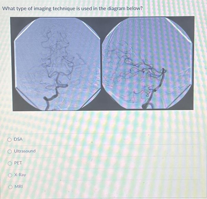 Solved What type of imaging technique is used in the diagram | Chegg.com