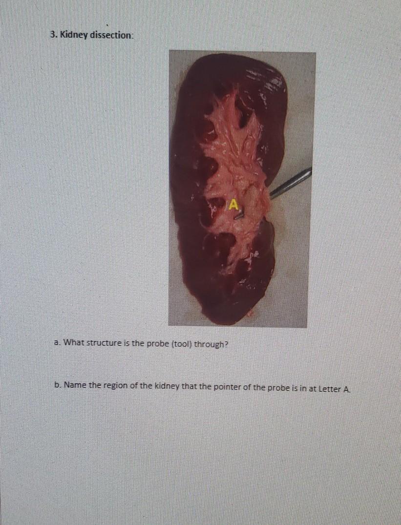 Question 3. Kidney Dissection A. What Structure Is The Probe (tool Through? B. Name The Region