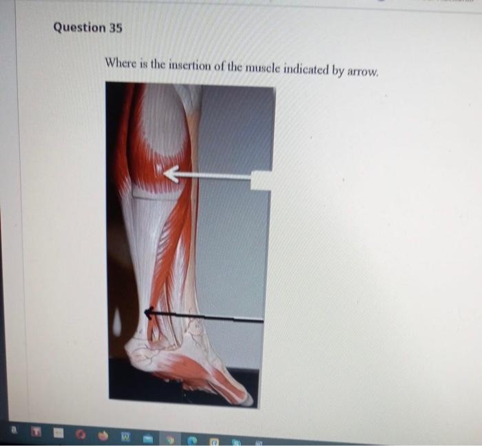 Solved Question 32 Identify one antagonist to the muscle | Chegg.com