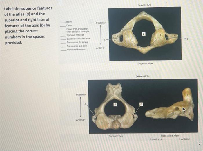 Solved Match The Bones In Column A With The Features In | Chegg.com