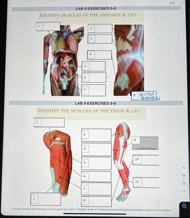 Solved Identify Muscles Of The Abdomen And Leg Inus Lab 9