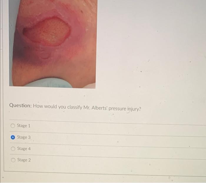 Solved Introduction Mr. Alberts is a 65-year-old man who | Chegg.com