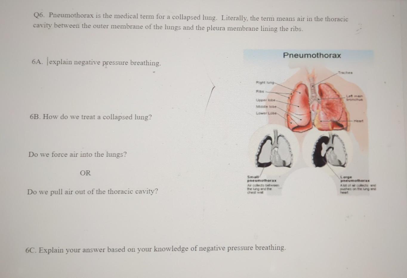 Solved Q6. Pneumothorax is the medical term for a collapsed 