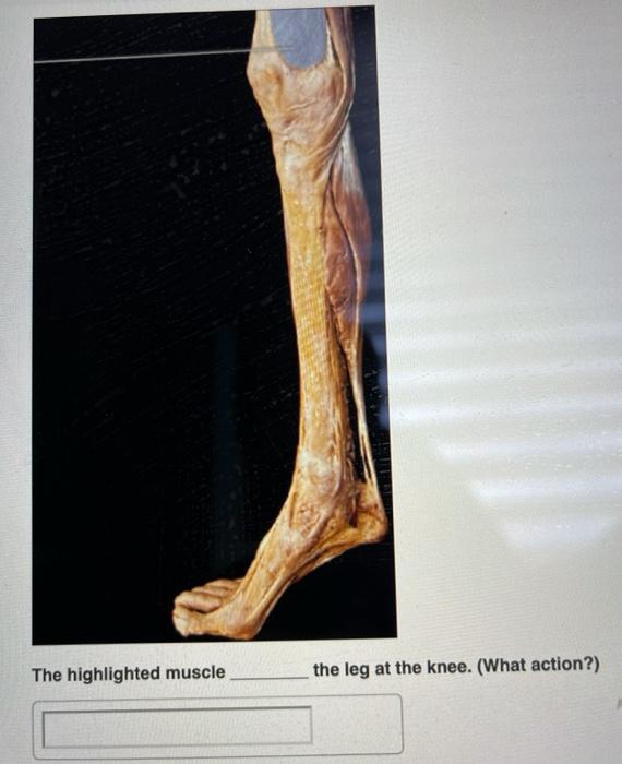 Solved Identify the highlighted muscle. The highlighted | Chegg.com