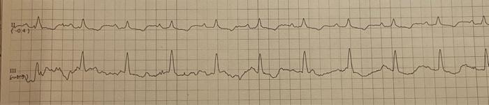 interprete the ECG | Chegg.com