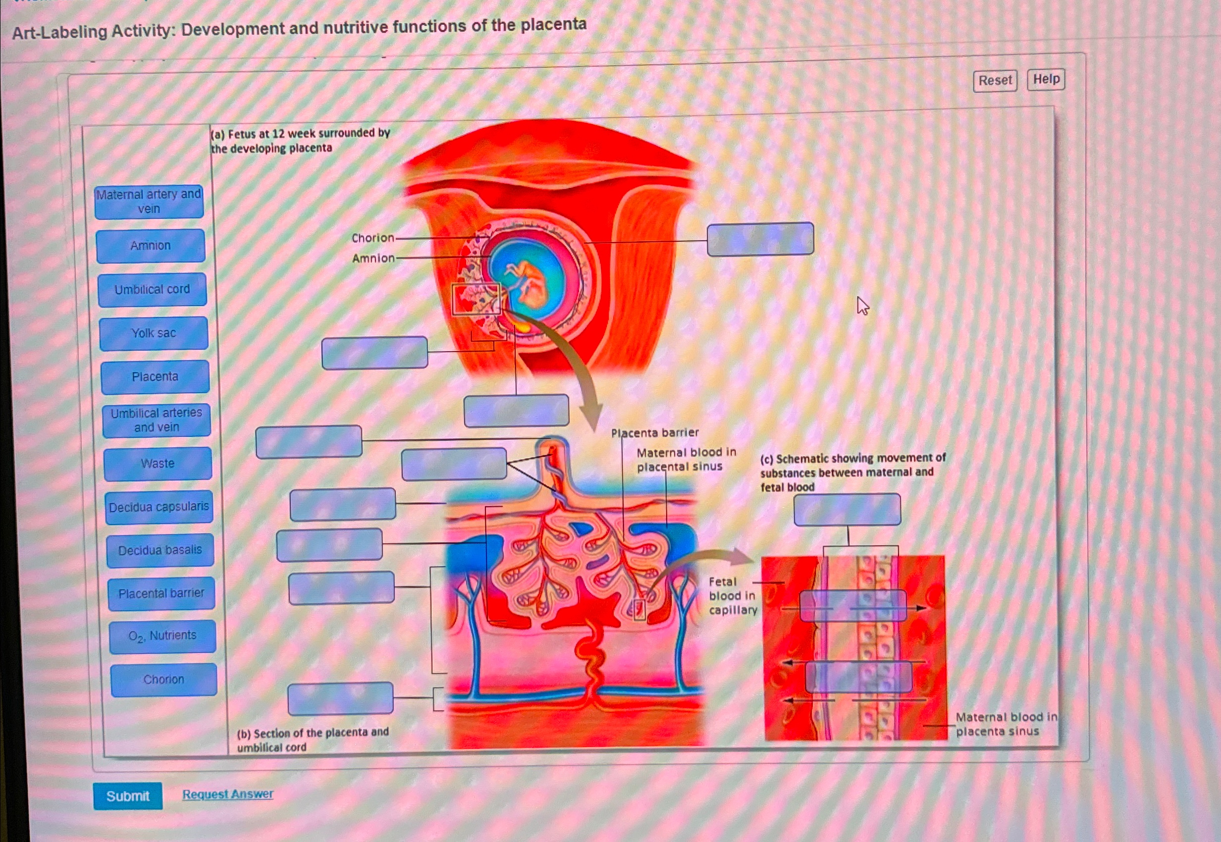 Art Labeling Activity Basic Anatomy Of The Skin - iwu9plk