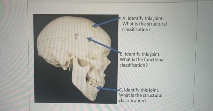 Solved A. Identify this joint What is the structural | Chegg.com