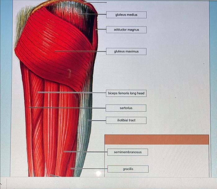 Solved gluteus medius gluteus maximus biceps femoris long | Chegg.com