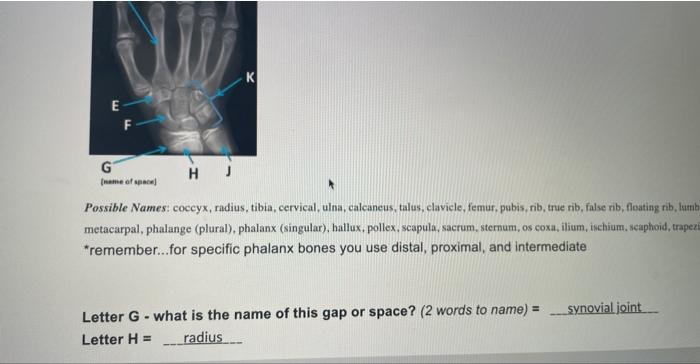 Solved Write in the feature name for each letter (or bone | Chegg.com