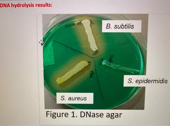 Solved Starch hydrolysis results: S. epidermidis I B. | Chegg.com