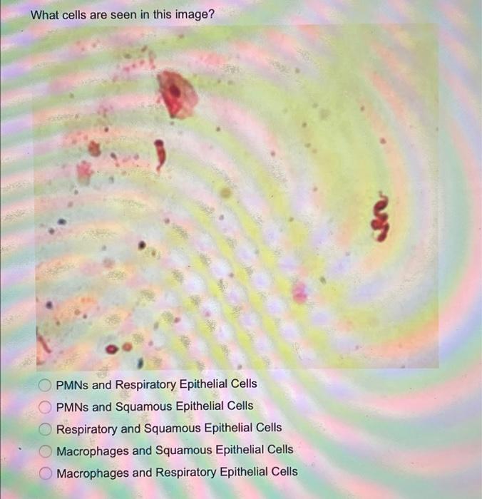 What cells are seen in this image? PMNs and | Chegg.com