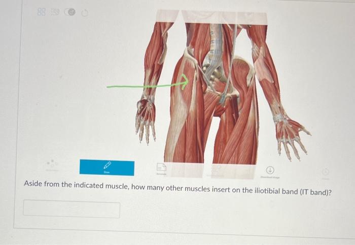 Solved Name one insertion of the indicated muscle Aside