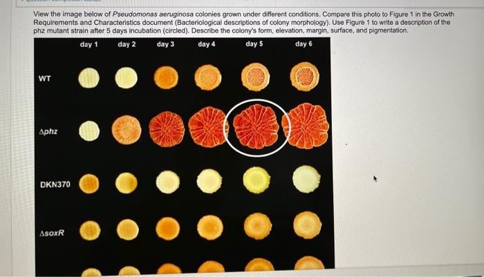 Solved View the image below of Pseudomonas aeruginosa | Chegg.com